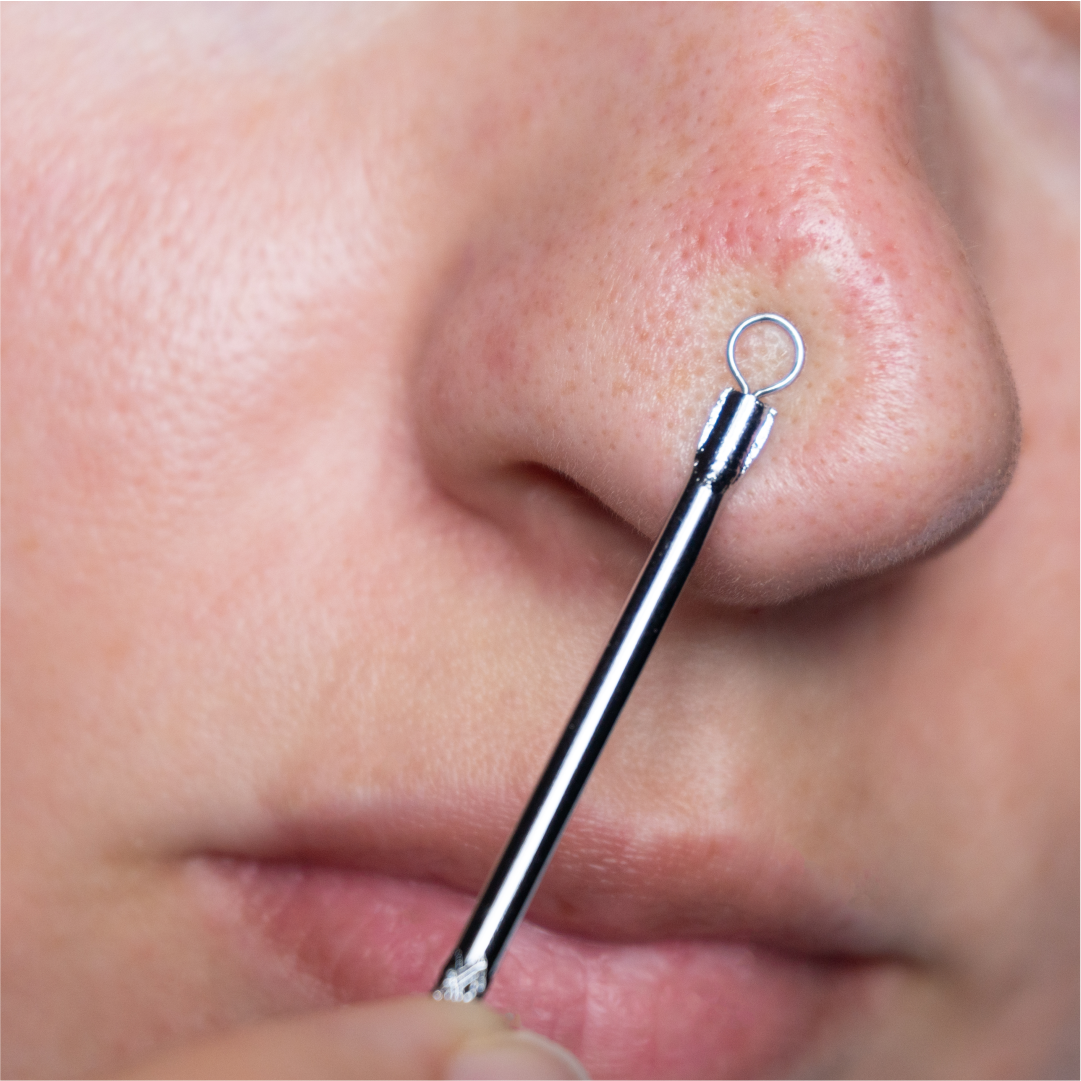 Come togliere i punti neri? I prodotti da usare | Royal Beauty