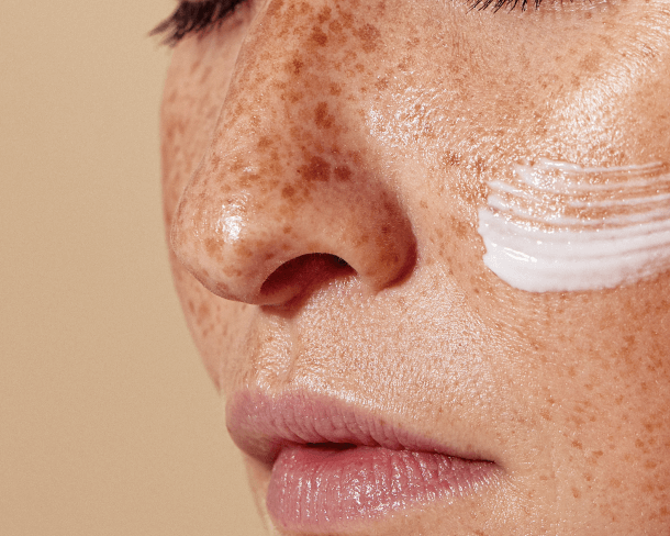 Macchie sul viso? Scopri come eliminarle | Royal Beauty