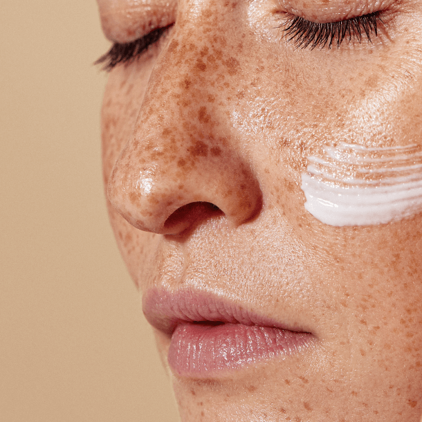 Macchie sul viso? Scopri come eliminarle | Royal Beauty